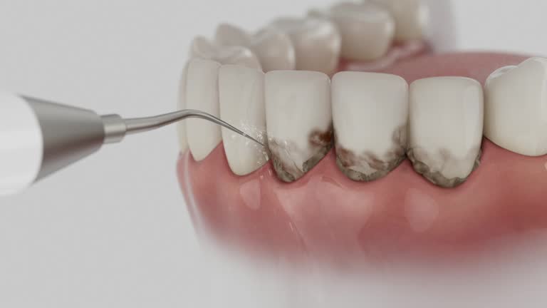 Trusted Tooth Extraction service in Georgetown, GA - Dentist Open Now